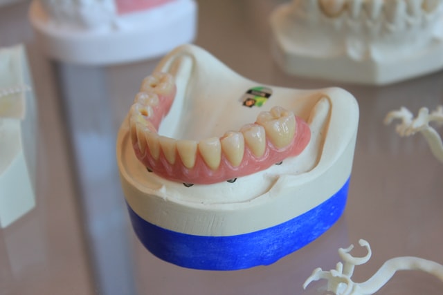 Protezy zębowe a szkieletowe - czym się różnią