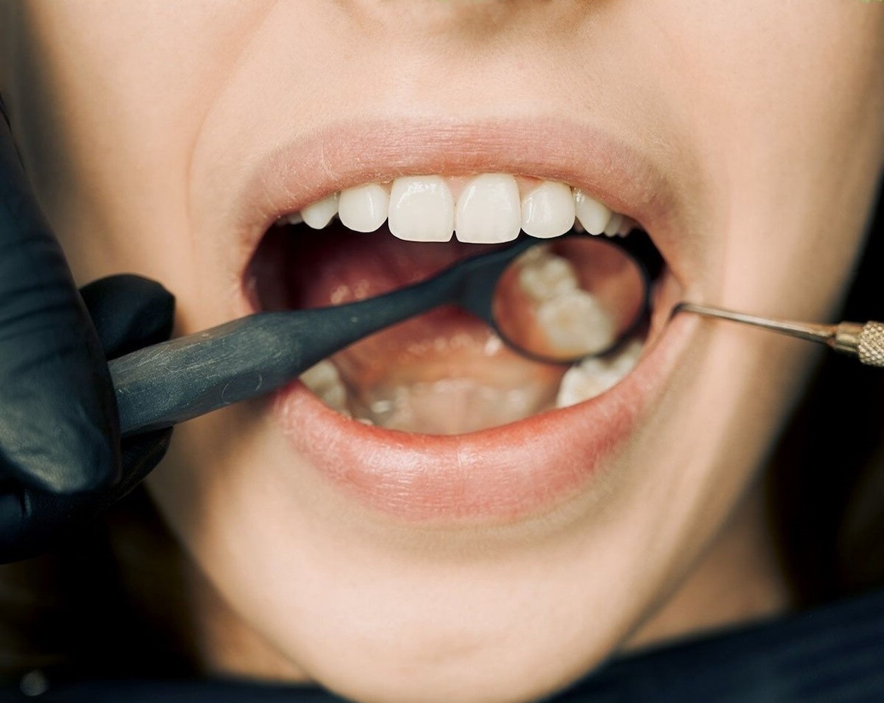 jak poradzić sobie z nadwrażliwością zębów